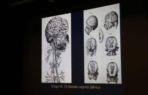 l-histoire-de-la-neurochirurgie-131749